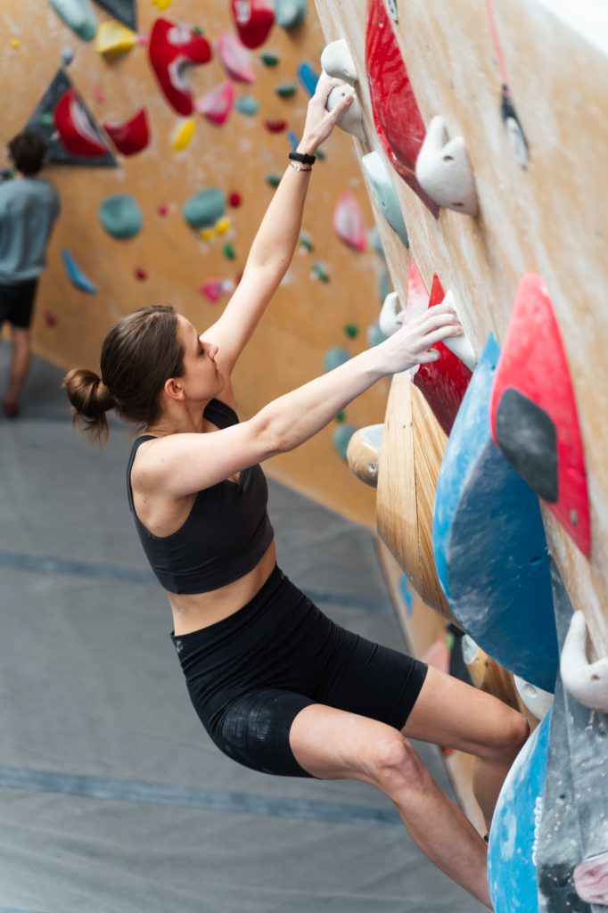 TFCC injury – uszkodzenie kompleksu chrząstki trójkątnej 1 Sylwia scianka net 21 TFCC injury – uszkodzenie kompleksu chrząstki trójkątnej