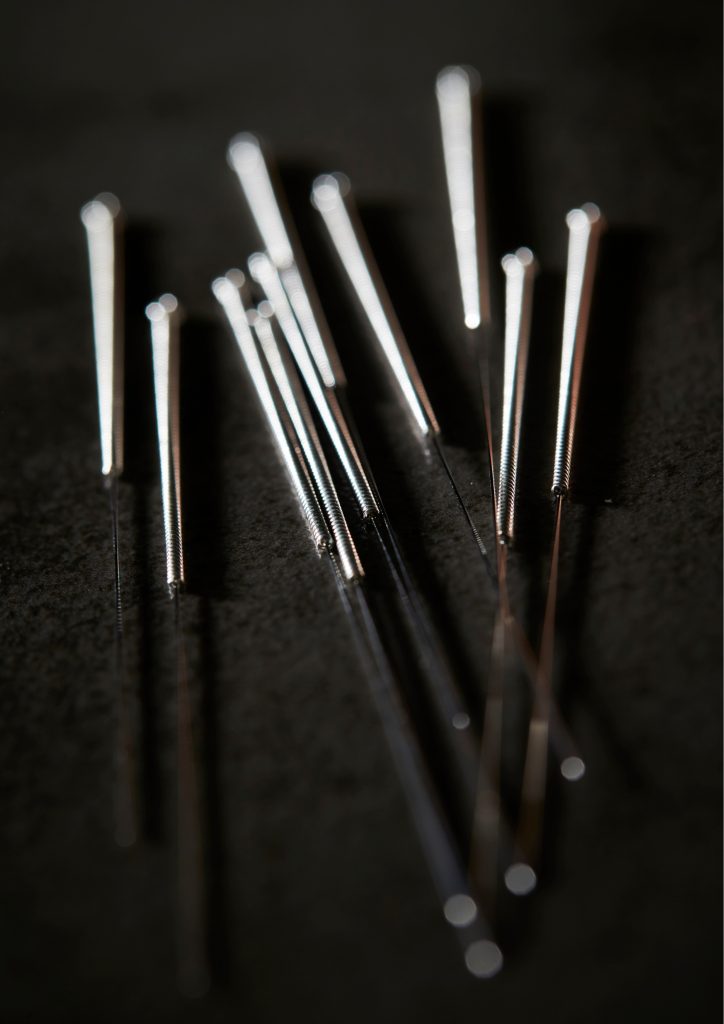 Suche iglowanie Suche igłowanie Gdańsk